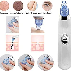 pore cleaning device
