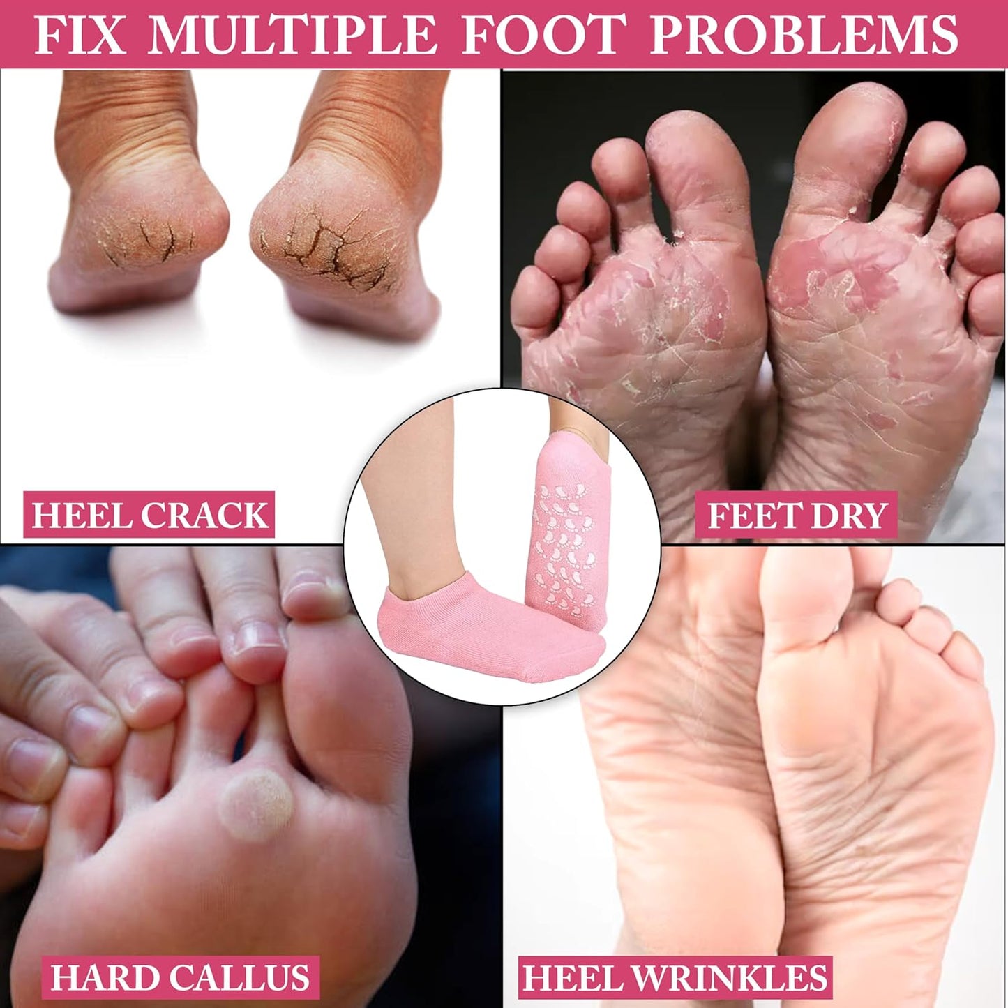 Moisturizing Silicone Gel Socks for Repairing Dry, Cracked Feet Skin, Pink