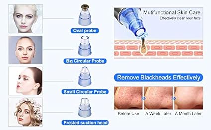 pore cleaning device