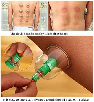 Hijama pull out a vacuum apparatus 12 pcs