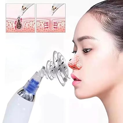 pore cleaning device