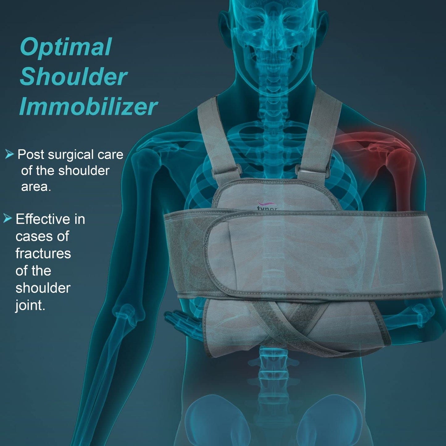 Tynor Universal Shoulder Immobiliser C02