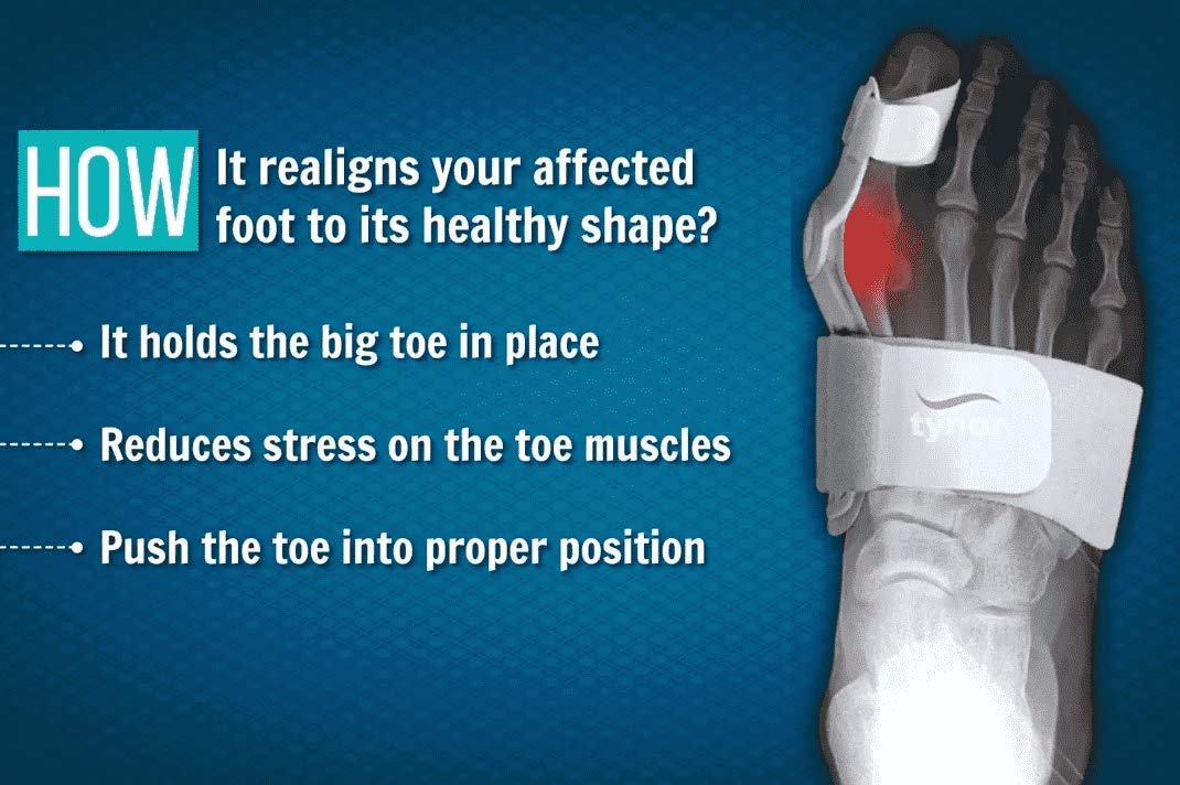 Tynor Bunion Splint UN K14