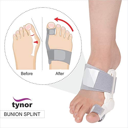 Tynor Bunion Splint UN K14