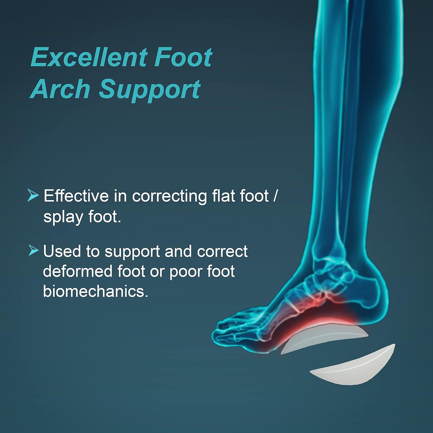 Tynor Arch Support Semi Pro K15