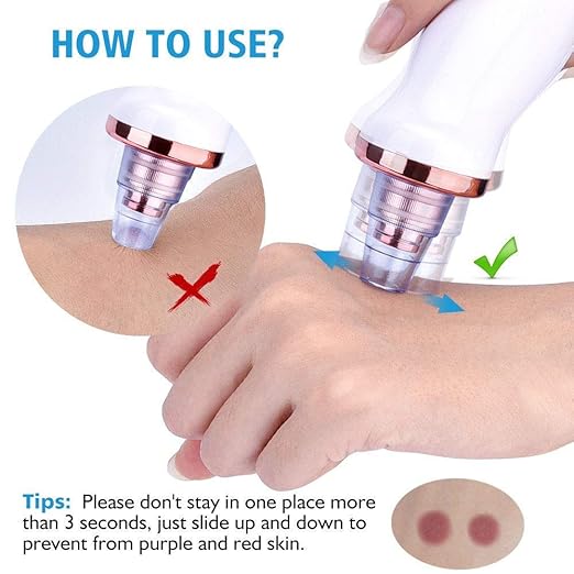 multi functional cleaning massager Blackhead Removal With Pimples & Pore Cleaner Upgraded Chargeable Vacuum Device/With 6 Changeable Functional Heads With 3 Levels Adjustable Mode