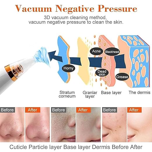 multi functional cleaning massager Blackhead Removal With Pimples & Pore Cleaner Upgraded Chargeable Vacuum Device/With 6 Changeable Functional Heads With 3 Levels Adjustable Mode